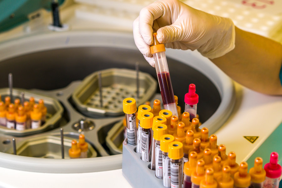 Röhrchen mit Blutproben werden in ein Laborgerät einsortiert